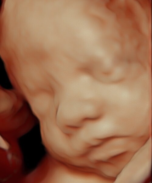 baby derksen_13 baby derksen_13